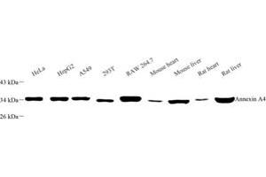Western blot analysis of Annexin-A4 (ABIN7073066) at dilution of 1: 500