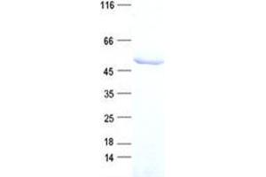 Western Blotting (WB) image for Tumor Susceptibility Gene 101 (TSG101) protein (DYKDDDDK Tag) (ABIN2734442)