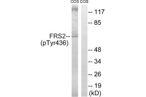 Western blot analysis of extracts from COS cells, using FRS2 (Phospho-Tyr436) antibody. (FRS2 Antikörper  (pTyr436))