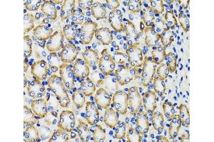 Immunohistochemistry of paraffin-embedded Rat kidney using COMT Polyclonal Antibody at dilution of 1:100 (40x lens). (COMT Antikörper)