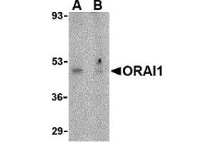 Western Blotting (WB) image for anti-ORAI Calcium Release-Activated Calcium Modulator 1 (ORAI1) (N-Term) antibody (ABIN1031496) (ORAI1 Antikörper  (N-Term))