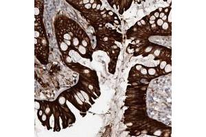 Immunohistochemical staining of human colon with CGN polyclonal antibody  shows strong cytoplasmic and membranous positivity in glandular cells at 1:50-1:200 dilution. (Cingulin Antikörper)