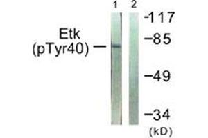 Western blot analysis of extracts from HepG2 cells, using ETK (Phospho-Tyr40) Antibody. (BMX Antikörper  (pTyr40))