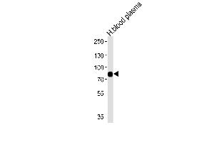 Western blot analysis of lysates from human blood plasma tissue (from left to right),using LRRC45 Antibody (C-term) (ABIN655315 and ABIN2844894). (LRRC45 Antikörper  (C-Term))