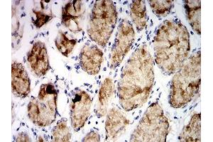 Immunohistochemistry (IHC) image for anti-Mucin 5AC, Oligomeric Mucus/gel-Forming (MUC5AC) (AA 5528-5627) antibody (ABIN5542622)