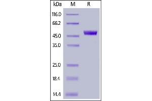 Fed Human CD4, His Tag on  under reducing (R) condition. (CD4 Protein (CD4) (AA 26-390) (FITC,His tag))