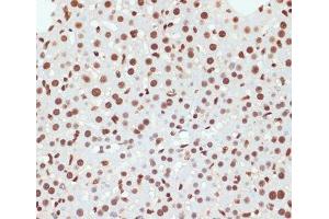Immunohistochemistry of paraffin-embedded Mouse liver using Phospho-POLR2A(S5) Polyclonal Antibody at dilution of 1:100 (40x lens).