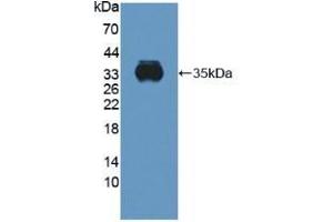 Detection of Recombinant CYBb, Human using Polyclonal Antibody to Cytochrome b-245 Beta Polypeptide (CYBb) (CYBB Antikörper  (AA 283-570))