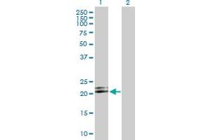 Western Blot analysis of LILRB2 expression in transfected 293T cell line by LILRB2 MaxPab polyclonal antibody. (LILRB2 Antikörper  (AA 1-193))