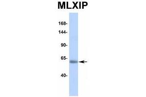 Host:  Rabbit  Target Name:  MLXIP  Sample Type:  Human Adult Placenta  Antibody Dilution:  1. (MLXIP Antikörper  (Middle Region))