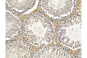 ABIN7096236 and ABIN7100298 at 1/100 staining rat testis tissue by IHC-P. (SYDE2 Antikörper)