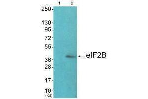 Western blot analysis of extracts from JK cells (Lane 2), using eIF2B (Ab-67) antiobdy. (EIF2S2 Antikörper  (N-Term))