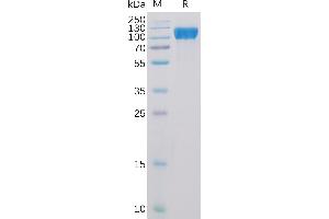 Human Protein, His Tag on SDS-PAGE under reducing condition.