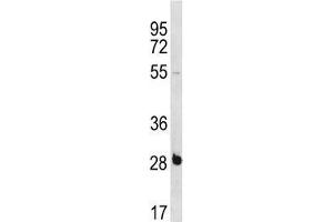 RBPMS antibody western blot analysis in NCI-H460 lysate. (RBPMS Antikörper  (AA 166-193))