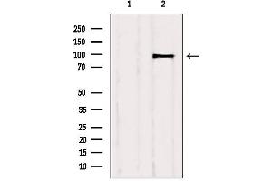 Western Blotting (WB) image for anti-Insulin-Like Growth Factor 1 Receptor (IGF1R) (C-Term) antibody (ABIN6262491)
