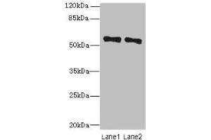 Western blot All lanes: ZNF689 antibody at 5 μg/mL Lane 1: Hela whole cell lysate Lane 2: HepG2 whole cell lysate Secondary Goat polyclonal to rabbit IgG at 1/10000 dilution Predicted band size: 57 kDa Observed band size: 57 kDa (ZNF689 Antikörper  (AA 1-300))