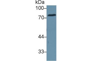 Western Blot; Sample: Human Serum; Primary Ab: 1µg/ml Rabbit Anti-Human CEA Antibody Second Ab: 0. (CEA Antikörper  (AA 566-698))