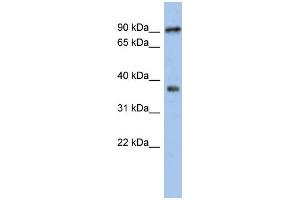 WB Suggested Anti-RSPH10B Antibody Titration: 0. (RSPH10B Antikörper  (Middle Region))
