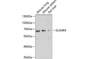 Western blot analysis of extracts of various cell lines using SLAMF6 Polyclonal Antibody at dilution of 1:1000. (SLAMF6 Antikörper)
