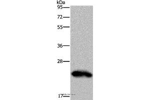 Western blot analysis of Human placenta tissue, using GH2 Polyclonal Antibody at dilution of 1:500 (Growth Hormone 2 Antikörper)