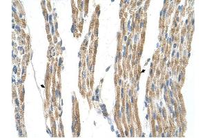 GPT antibody was used for immunohistochemistry at a concentration of 4-8 ug/ml to stain Skeletal muscle cells (arrows) in Human Muscle. (ALT Antikörper)
