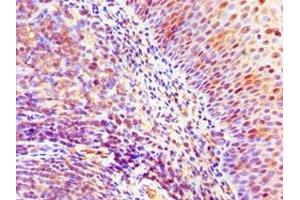Immunohistochemistry of paraffin-embedded human tonsil tissue using ABIN7169428 at dilution of 1:100 (ASH2L Antikörper  (AA 329-628))