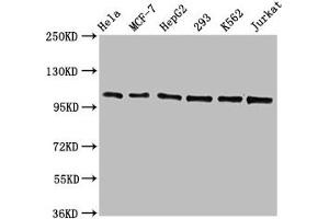 Western Blot Positive WB detected in: Hela whole cell lysate, MCF-7 whole cell lysate, HepG2 whole cell lysate, 293 whole cell lysate, K562 whole cell lysate, Jurkat whole cell lysate All lanes: CDC5L antibody at 1. (Rekombinanter CDC5L Antikörper)