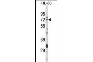 Western blot analysis of DTX4 Antibody (N-term) (ABIN652817 and ABIN2842533) in HL-60 cell line lysates (35 μg/lane). (Deltex Homolog 4 Antikörper  (N-Term))