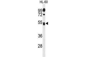 Western blot analysis of SPN Antibody (Center) in HL-60 cell line lysates (35µg/lane). (CD43 Antikörper  (Middle Region))