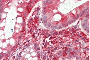 ABIN768660 (5µg/ml) staining of paraffin embedded Human Colon. (TFB2M Antikörper  (Internal Region))