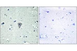 Immunohistochemistry analysis of paraffin-embedded human brain tissue, using ETBR2 Antibody. (ETBR2 Antikörper  (AA 1-50))
