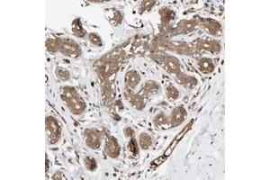 Immunohistochemical staining of human breast with OTUD6B polyclonal antibody  shows distinct cytoplasmic positivity in glandular cells at 1:50-1:200 dilution. (OTUD6B Antikörper)