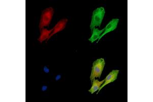 ABIN7096903 and ABIN7100969 staining  cells by IF/ICC.