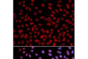 Immunofluorescence analysis of U2OS cells using DNA polymerase eta Polyclonal Antibody (POLH Antikörper)