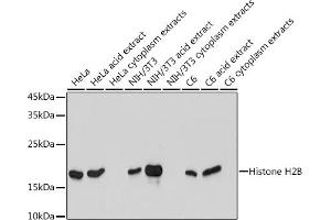 Western blot analysis of extracts of various cell lines, using Histone H2B antibody (ABIN7267736) at 1:1000 dilution. (HIST1H2BK Antikörper)