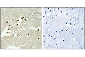 Immunohistochemistry analysis of paraffin-embedded human brain tissue, using NCOA5 Antibody. (NCOA5 Antikörper  (AA 345-394))