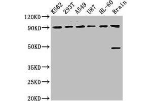 Western Blot Positive WB detected in: K562 whole cell lysate, 293T whole cell lysate, A549 whole cell lysate, U87 whole cell lysate, HL60 whole cell lysate, Rat brain tissue All lanes: OCA2 antibody at 8. (OCA2 Antikörper  (AA 2-136))