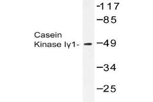 Western blot (WB) analysis of Casein Kinase Igamma1 antibody in extracts from COS-7 cells. (CSNK1G1 Antikörper)