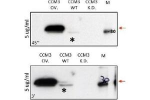 Western Blot using Anti Human CCCM3 antibody Cat. (PDCD10 Antikörper  (N-Term))