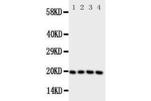 Western Blotting (WB) image for anti-Lipocalin 1 (LCN1) (AA 110-124), (Middle Region) antibody (ABIN3043125) (Lipocalin 1 Antikörper  (Middle Region))