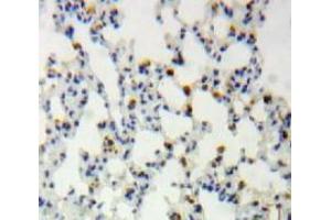 IHC-P analysis of Lung tissue, with DAB staining. (CLIC4 Antikörper  (AA 104-253))