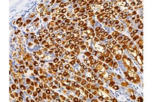 ABIN6259968 and ABIN6266497 at 1/100 staining Rat stomach tissue by IHC-P. (APAF1 Antikörper  (C-Term))