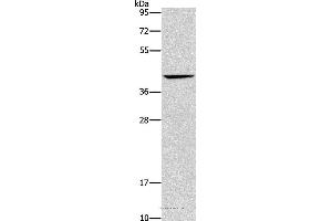 Western blot analysis of Mouse liver tissue, using ORM2 Polyclonal Antibody at dilution of 1:500 (Orosomucoid 2 Antikörper)