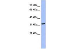 Image no. 1 for anti-Melanoma Antigen Family B, 2 (MAGEB2) (N-Term) antibody (ABIN6744050) (MAGEB2 Antikörper  (N-Term))