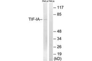 Western blot analysis of extracts from HeLa cells, treated with calyculinA 50ng/ml 30', using TIF-IA (Ab-649) Antibody. (RRN3 Antikörper  (AA 602-651))