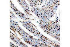 IHC analysis of CD31/Pecam1 using anti-CD31/Pecam1 antibody (ABIN7601662). (CD31 Antikörper  (AA 41-258))