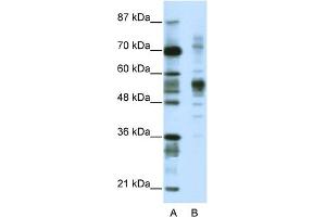 WB Suggested Anti-CORO1A Antibody Titration:  1. (Coronin 1a Antikörper  (C-Term))