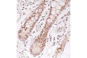 Immunohistochemistry (IHC) image for anti-Checkpoint Kinase 2 (CHEK2) antibody (ABIN487488) (CHEK2 Antikörper)