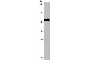 Western Blotting (WB) image for anti-Plasminogen (PLG) antibody (ABIN2435220) (PLG Antikörper)