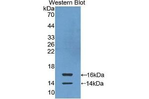 Western Blotting (WB) image for anti-Chemokine (C-C Motif) Ligand 24 (CCL24) antibody (FITC) (ABIN1862929) (CCL24 Antikörper  (FITC))